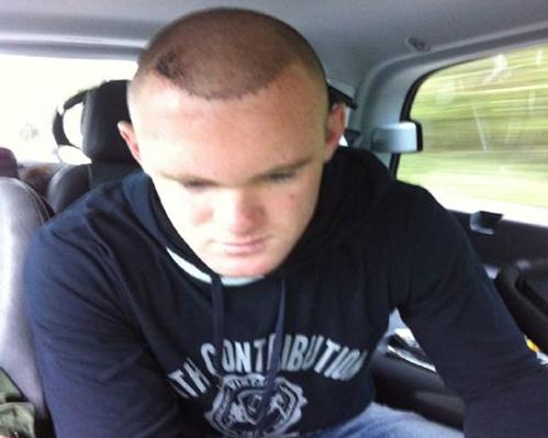 Rooney Hair Restorative Spokesman
