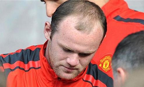 Rooney as Hair Restorative spokesman